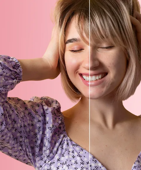 brfore and after pigmentation treatments